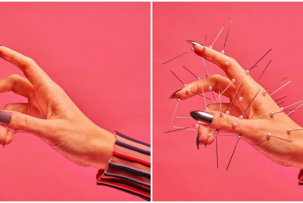 2 hands. One normal hand. The other hand has various needles indented into the hand